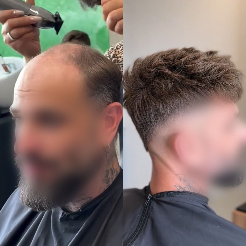 Avant et après la pose d'un complément capillaire